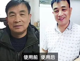 王醫(yī)生的對比